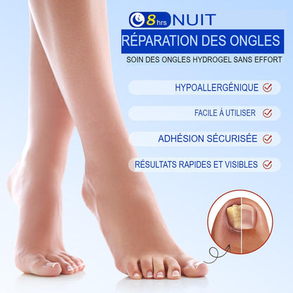 ProtectOngle Pro™ | Répare vos ongles pendant votre sommeil !