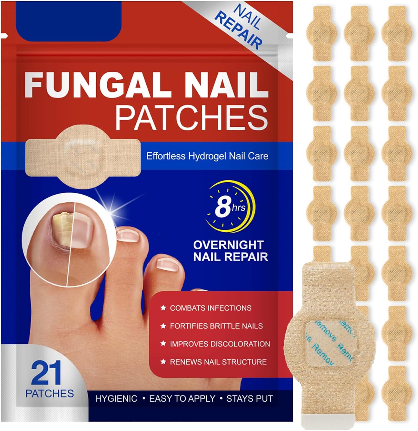 ProtectOngle Pro™ | Répare vos ongles pendant votre sommeil !