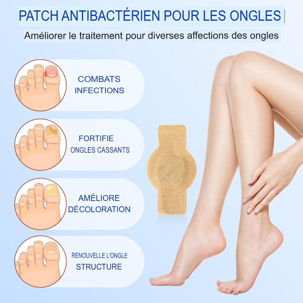 ProtectOngle Pro™ | Répare vos ongles pendant votre sommeil !