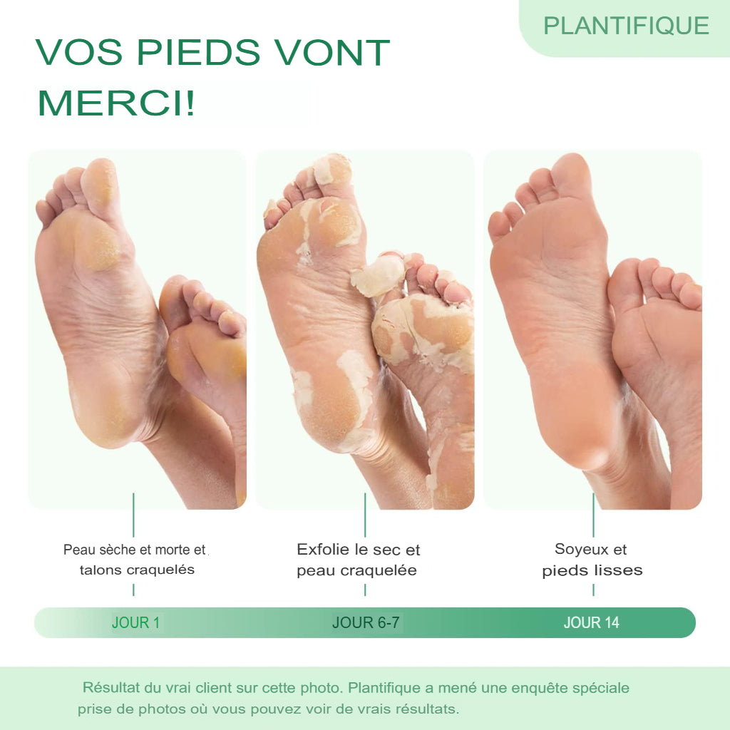 Masque Réparateur 7 Jours Pieds Neufs -  Des pieds neufs en quelques jours