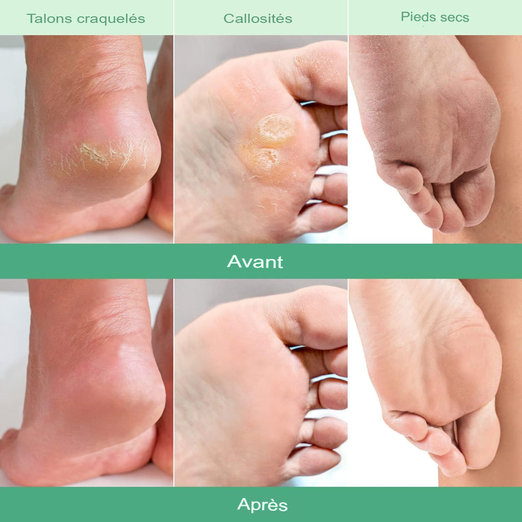 Masque Réparateur 7 Jours Pieds Neufs -  Des pieds neufs en quelques jours